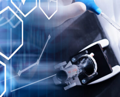 ‘Becky’ 27 Case Study