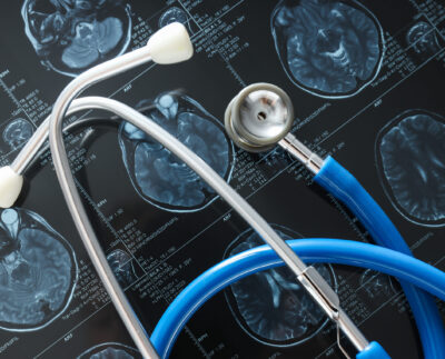 ‘Michelle’ 36 Case Study