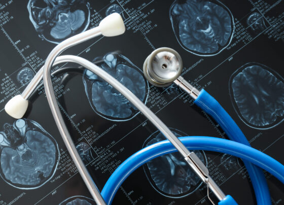 ‘Michelle’ 36 Case Study